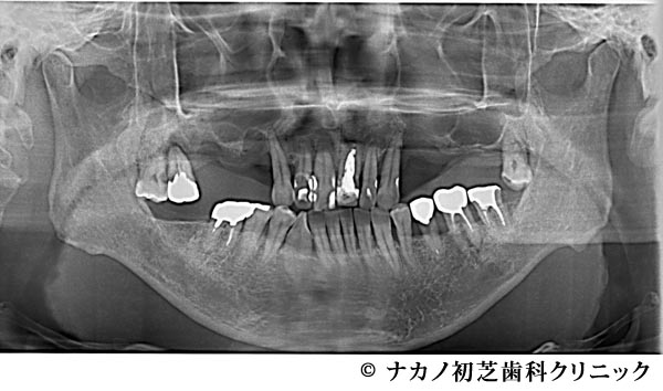 治療前