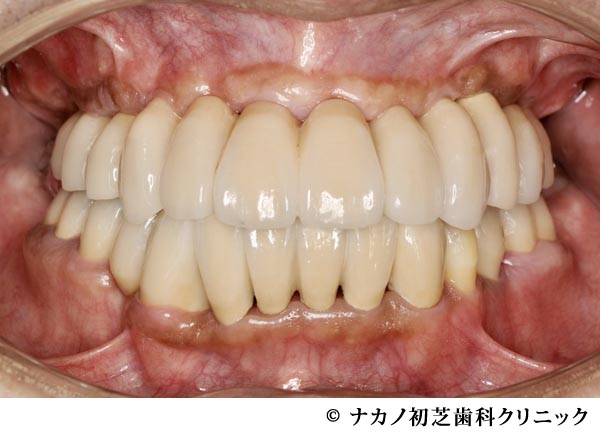 治療後
