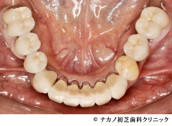 治療後