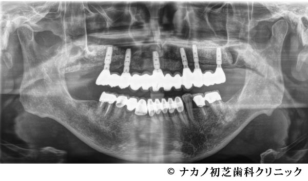 治療後