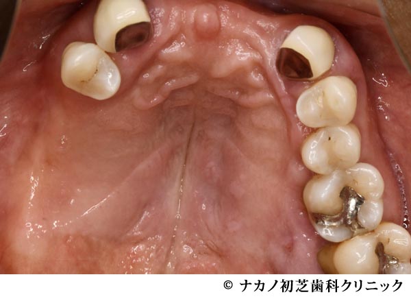 治療前