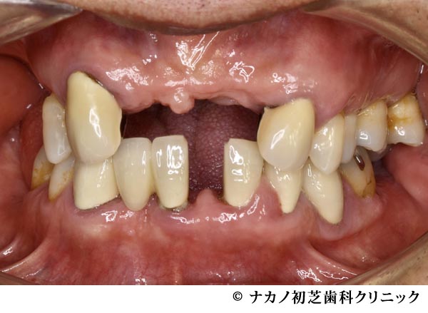 治療前