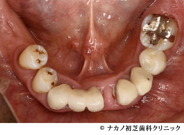 治療前