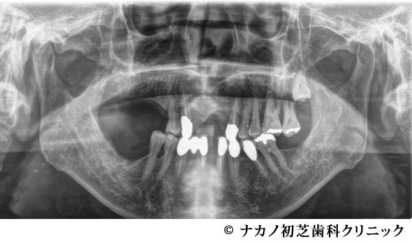 治療前