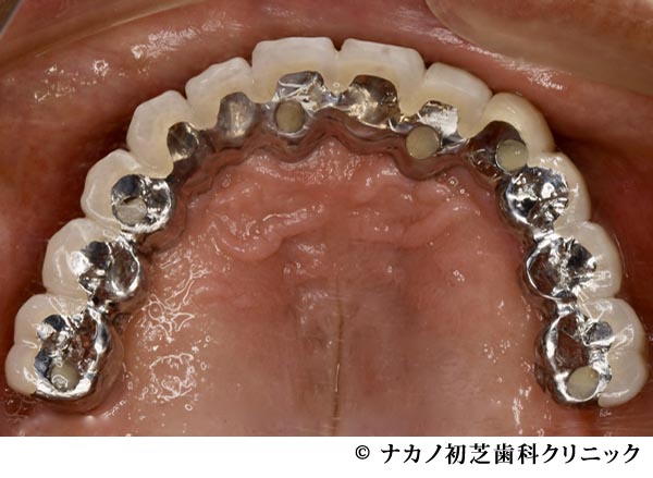 治療後