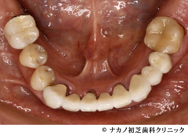 治療後