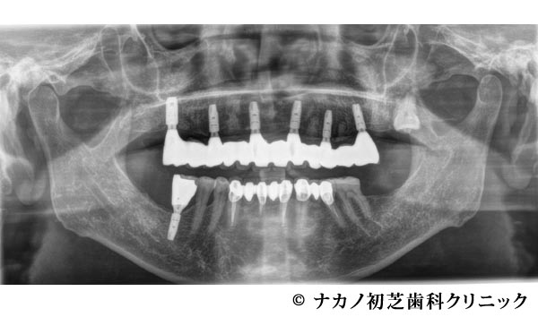 治療後