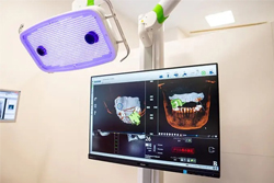 ������CT�ȥ���ץ��ȼ�ѥʥӥ�������󥷥��ƥ�����