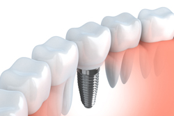 ������¤������