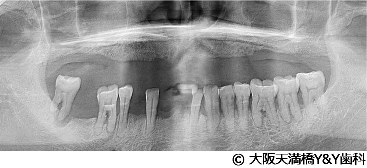 治療前