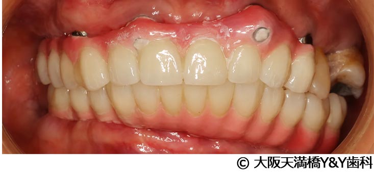 治療後