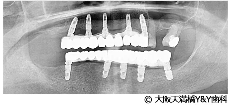 治療後