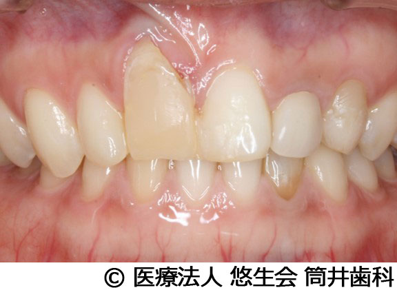 治療前