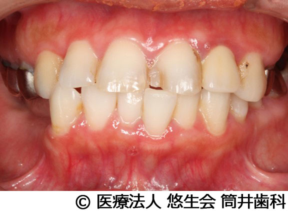 治療前