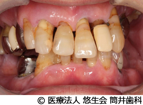 治療前
