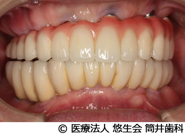 治療後