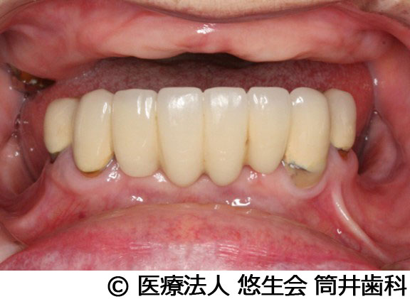 治療前