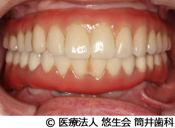 治療後