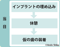 All-on-4手術当日の流れ