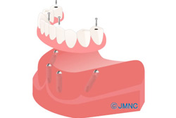 ���������ܥ���ץ��ȼ��Ť���ħ<