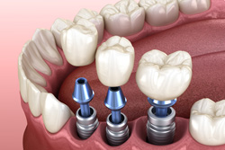 ׼ˡ ܸХץȳز ǤĹô