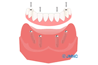 Ǿ4ܤΥץȤǼŤAll-on-4(륪ե)