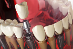 ξ�٤�η����ʻ�����ޤ���