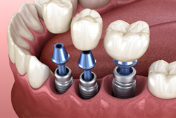 ������򤷤ä�����ꤷ�ޤ�