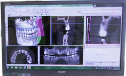 3Dシミュレーションソフト