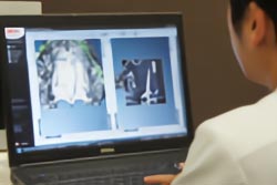 3Dシミュレーションを用いた治療