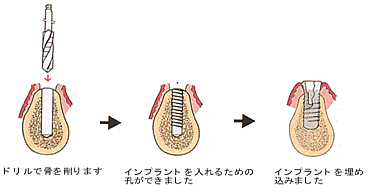 ͹