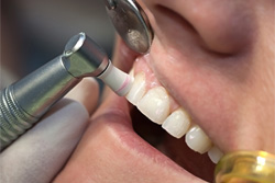 ͽ��ᥤ��ƥʥ󥹤ν���