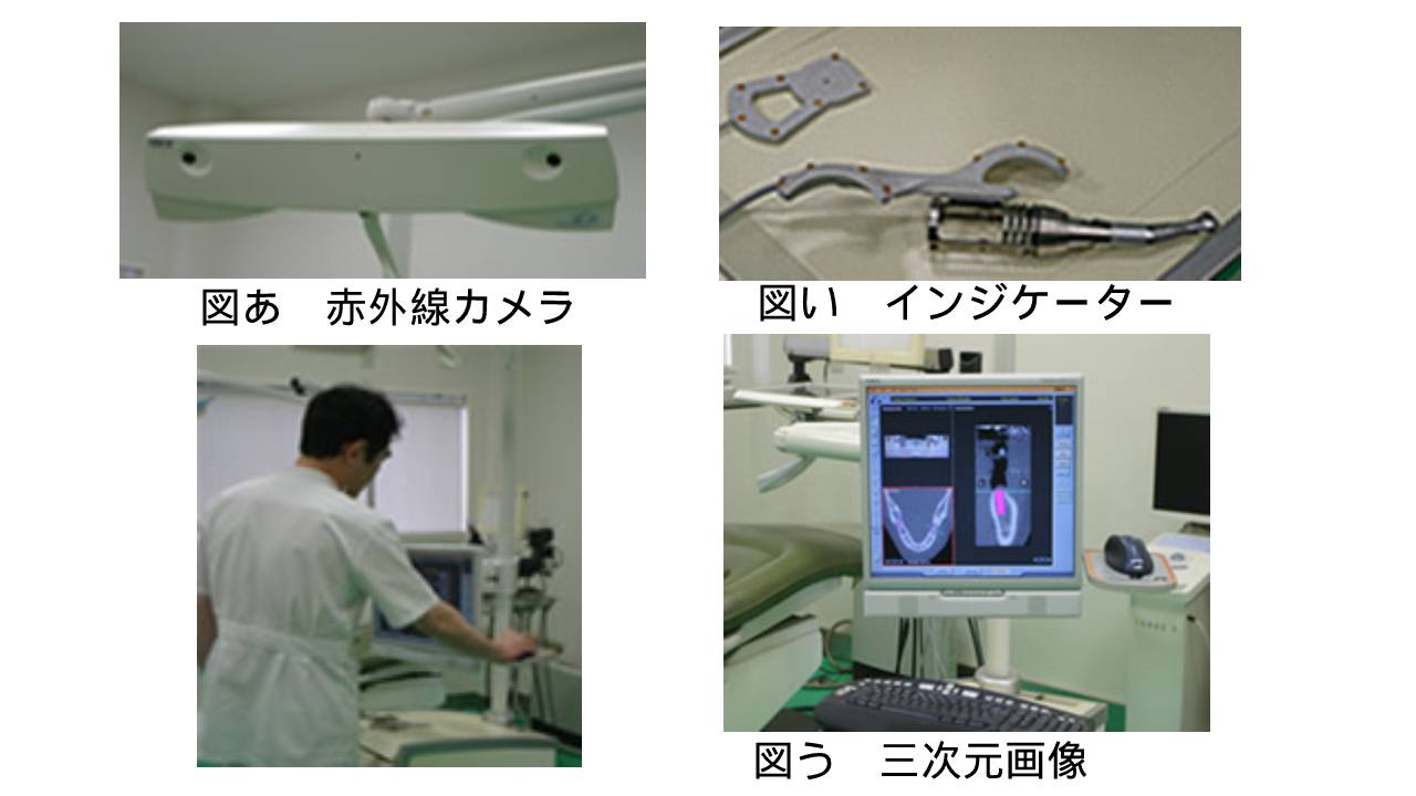 IGIインプラントシステム