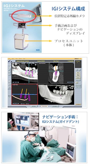 切らない、腫れない、痛くないインプラント