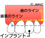 [見た目を特に追求したい方へ]