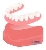 総入れ歯の治療の場合