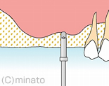 穴を開けます