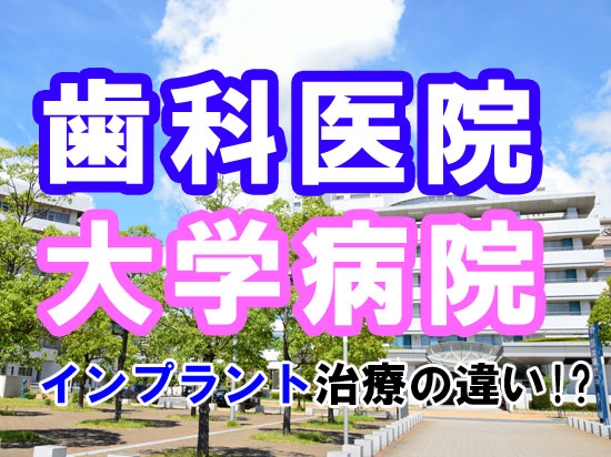 歯科医院と大学病院で受けるインプラント治療の違い