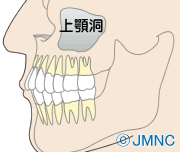 かゆい うわ あご