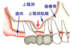 初期状態①