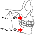 顎骨骨髄炎の原因と症状について