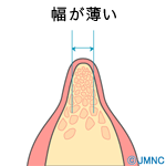 幅が薄くなった顎の骨