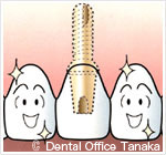 健全な歯は全く削らず治療可能