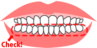 治療後の歯の大きさ、形、