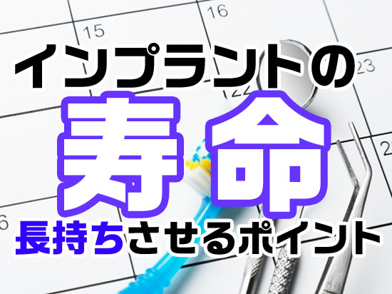 インプラントの寿命はどれくらい？長持ちさせる3つのポイント