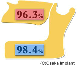  骨結合型インプラントの臨床実績 