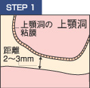 STEP1　ハイドロテクニック
