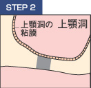 STEP2 穴をあける