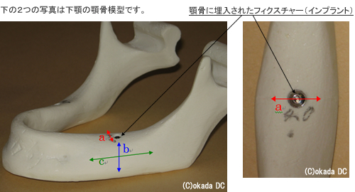 下顎の額骨模型