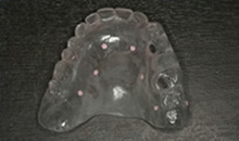 STEP2 ラジオグラフィックガイドを作製・CT撮影